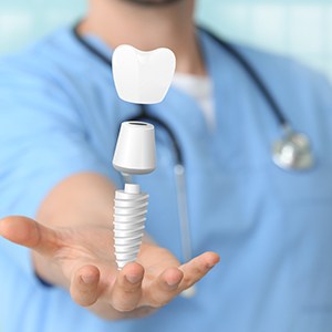Digital image of dental implant parts