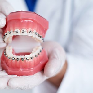 Dentist in Rowlett considering displaying braces