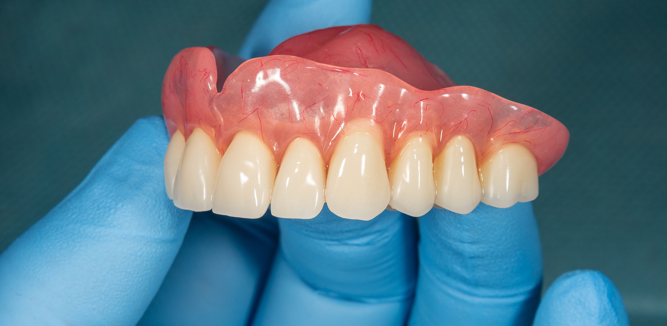 Dentures can restore your smile on a budget