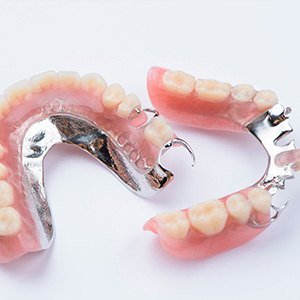 Partial dentures are ideal for patients missing only a few teeth on an arch