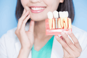 Dentist smiling while holding a model of a dental implant
